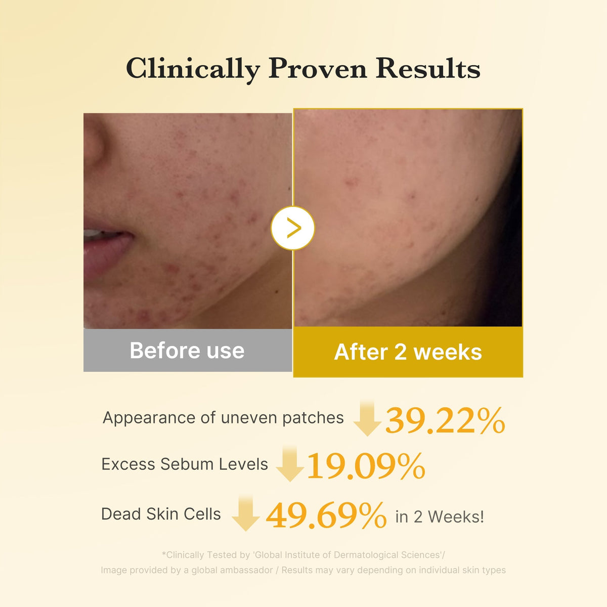 Medicube Kojic Acid Turmeric Pad — 70 Pads