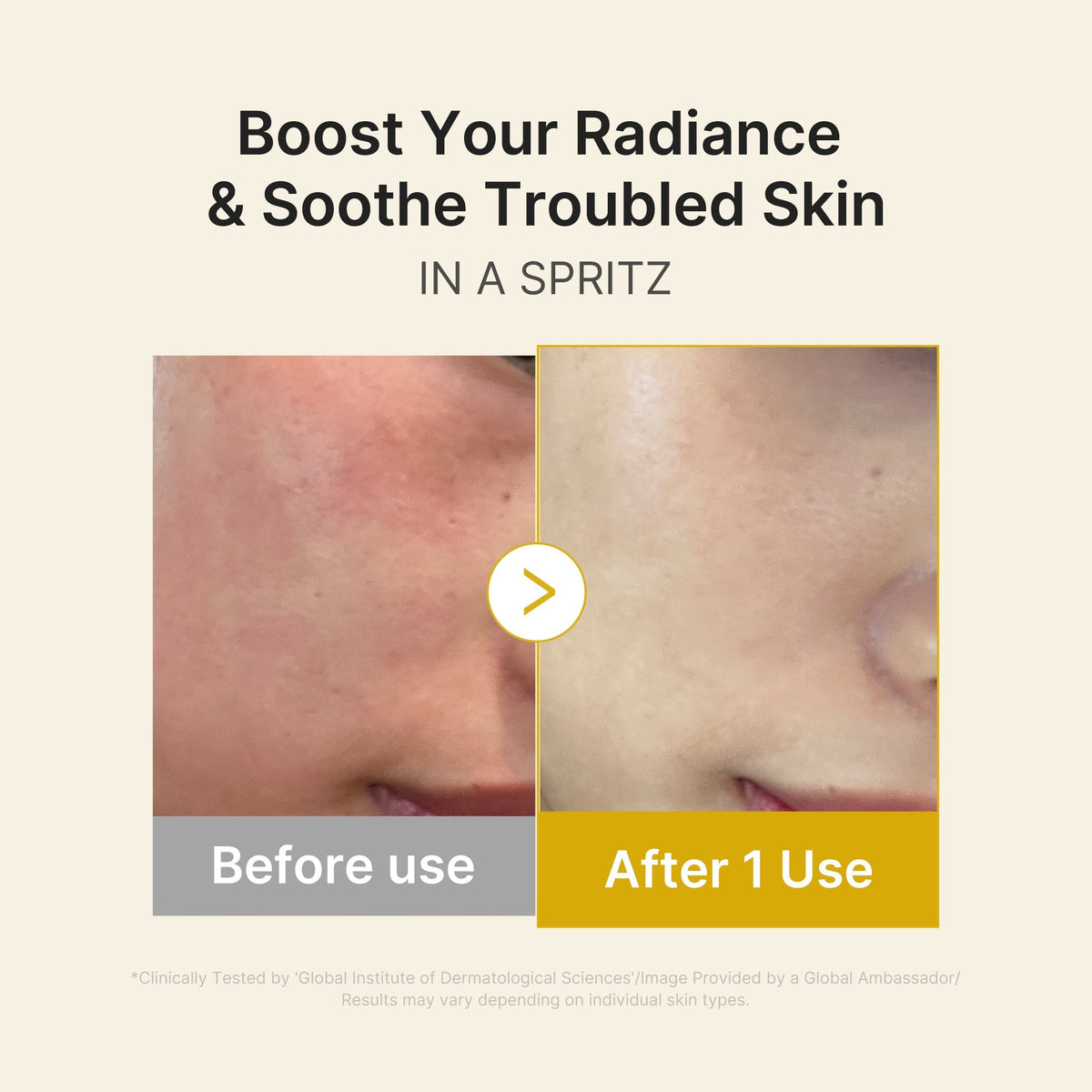 Medicube Kojic Acid Turmeric Vita Jelly Mist Serum — 100 mL