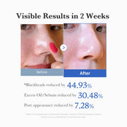 Medicube Zero Pore Pad 2.0 — 70 Pads