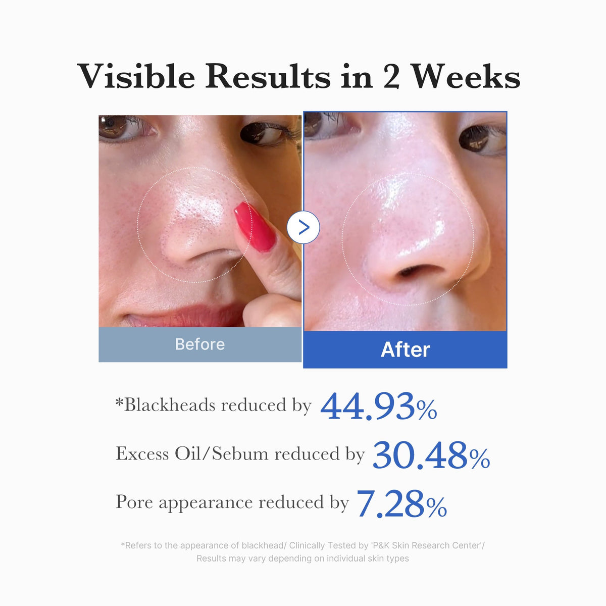 Medicube Zero Pore Pad 2.0 — 70 Pads