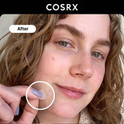 COSRX Acne Pimple Master Patch — 24 Patches