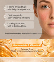 NINELESS MELA-PRO 5% TXA Serum — 30 mL